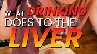 What Drinking Does To Your Liver [upl. by Marlie760]