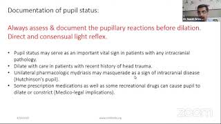 Theory and Practice of Mydriatics amp Cycloplegics [upl. by Lenad620]