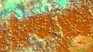 Penicillium Sp [upl. by Oberheim]