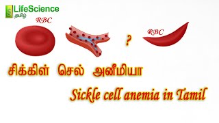 Sickle cell anemia in Tamil  LIFESCIENCE TAMIL  TRB ZOOLOGY  TNSET LIFESCIENCE  TNPSC  NEET [upl. by Amarette342]