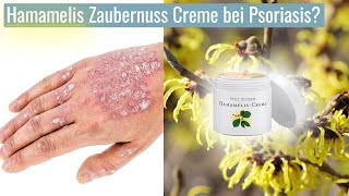 Hilft Hamamelis Zaubernuss Creme bei Schuppenflechte [upl. by Ytirahc]