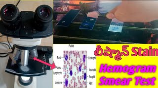 Leishman staining in Telugu  Blood smear Hemogram staining in Telugu  BRavikumar [upl. by Adnarym]