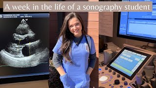 Week in the life of a Sonography Student [upl. by Modla]