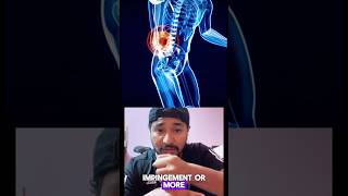 Trendelenburg gait how it’s cause  glutes medius weakness neurological hip pathology shortvideo [upl. by Rolecnahc861]