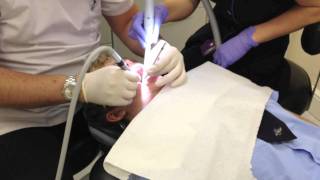 dentist injection drill and filling [upl. by Nosyt]