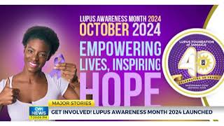 Get Involved Lupus Awareness Month 2024 Launched  CVMTVNews [upl. by Ahseryt]