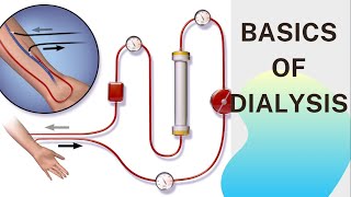 Basic concept of Dialysis Machine  Fresenius 4008S  Dialyzer amp Dialysate Function [upl. by Nealey807]