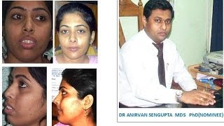 ARPITA SHEULI DASDR ANIRVAN SENGUPTAS PATIENTs INTERVIEW AFTER TREATMENT [upl. by Bowers]