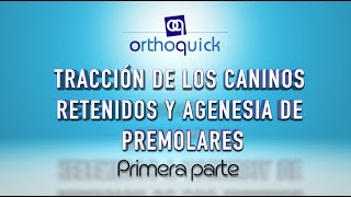 TRACCIÓN DE LOS CANINOS RETENIDOS Y AGENESIA DE PREMOLARES PRIMERA PARTE [upl. by Siusan]