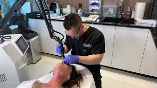 Ablative Erbium Laser for Skin Resurfacing  West Hollywood CA  Dr Jason Emer [upl. by Aramen]