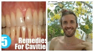 How To Heal Cavities Strengthen And Remineralize Teeth amp Bones Ligaments Joints Flesh amp Tendons [upl. by Selway]