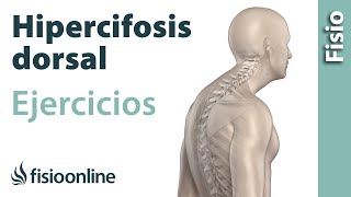 Ejercicio para eliminar por completo la hipercifosis dorsal [upl. by Edwine]