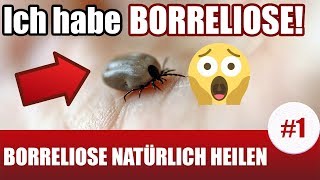 Ich habe Borreliose Borreliose Behandlung natürlich 1 [upl. by Fini]