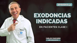 EXODONCIAS INDICADAS EN CLASES I  EPISODIO 52 [upl. by Girish]