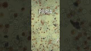 Piuria Aumento de leucocitos en orina labclinico🦠🔬 ego examengeneraldeorina piuria [upl. by Allin]