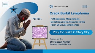 Burkit Lymphoma  NonHodgkin Lymphomas  Visual Mnemonics  Crack NEET PG  USMLE [upl. by Torrin]