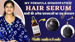 Homeopathic Hair Serum  For All your Hair Problems  My Formula Serum  Dr Arwa Bohra [upl. by Bowers]