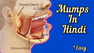 MUMPS in HINDI  Symptoms  causes  diagnosis  treatment  Vaccination  Tarang academy [upl. by Landsman329]