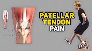 3 Exercises for Jumper’s Knee Patellar Tendinopathy [upl. by Ronn]