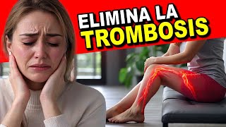 NO MUERAS por TROMBOSIS y COAGULOS La GUIA MAS COMPLETA de TROMBOSIS VENOSA PROFUNDA [upl. by Nnaeel]