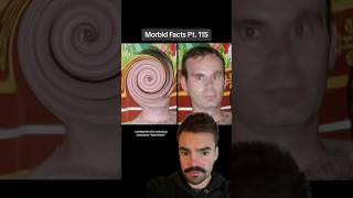 The DISTURBING dark web case of Swirl Face morbidfacts [upl. by Myrtia207]