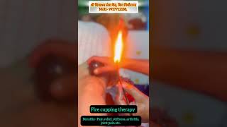 Fire cupping therapy 🔥  Shivashram wellness Pithoragarh [upl. by Enelym]