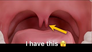 Visit the ENT Doctor with me uvula nasal [upl. by Anallese397]