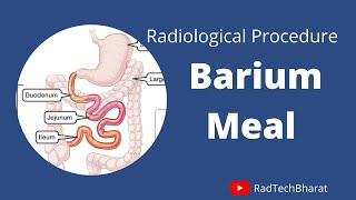 Radiological Barium Meal Procedure [upl. by Dusa]