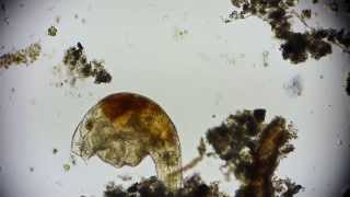 Mikroorganismus  microorganism  microorganisms under microscope in 1080p Full HD [upl. by Sinnelg]