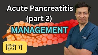 Acute Pancreatitis को कैसे manage करें। Acute Pancreatitis treatment in hindi [upl. by Iramo]