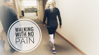 First prosthetic leg as an amputee On her own two feet after BKA amputation [upl. by Ewnihc]