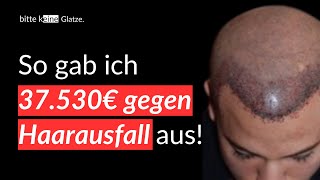 16 Jahre Haarausfall und 37000€ später Meine haarausfall und haartransplantation Geschichte [upl. by Eillib550]