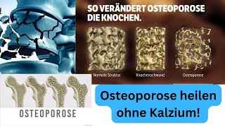 Osteoporose ist KEIN Kalziumproblem [upl. by Xonel]