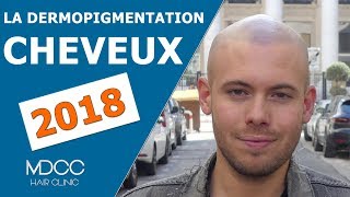 La dermopigmentation des cheveux avec notre patient de Paris [upl. by Rafat]