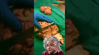 Why Albert Einstein Brain cut into 240 pieces [upl. by Nebeur]