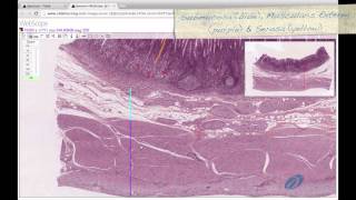 Histology Helper  Digestive System II Histology [upl. by Chew]