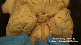 Vertebrobasilar system posterior circulationneuroanatomy blood supply arteriesmedicalstudent [upl. by Yelwah]