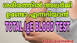 Allergy test malayalam total IgE blood test allergies allergy allergytreatment bloodtest [upl. by Dnaltiac]