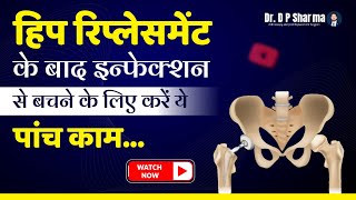 5 Things to Prevent Infection After Hip Replacement  Hip Surgeries In DelhiNCR amp AgraDr DP Sharma [upl. by Arezzini693]