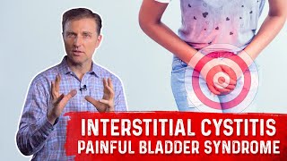 What is Interstitial Cystitis Painful Bladder Syndrome – Symptoms amp Remedy Covered by DrBerg [upl. by Tedda]