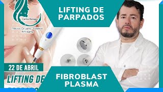 Curso Online Lifting de Parpados FIBROBLASTPLAMA PEN [upl. by Notnelc69]