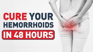 Treatments For HemorrhoidsHOW TO Shrink Hemorrhoids FAST And NaturallyTreatments For Hemorrhoids [upl. by Wolfgang]