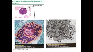 La réaction inflammatoire TS [upl. by Anay]