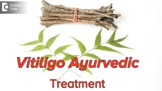 How can we treat vitiligowhite patchesthrough Ayurveda  Dr Mini Nair [upl. by Teyut]