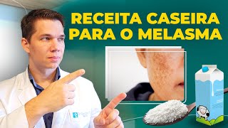 Melasma Tratamento Caseiro para uma Pele Radiante [upl. by Aneekan]