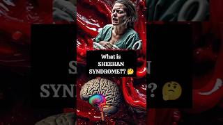 Whats SHEEHAN SYNDROME  Obstetrics  education mbbs biology medicalstudent medicine study [upl. by Naehs41]