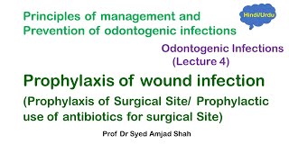 Prophylaxis of wound infection  Prophylaxis of Surgical Site  HindiUrdu [upl. by Rico121]