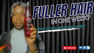 Biotin and Collagen Shampoo Review  Thicker Stronger Fuller Hair In a Week😱  XHC Product Review [upl. by Halilad]