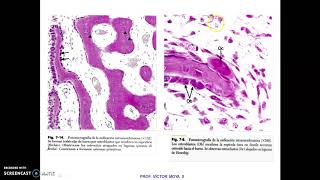 Clases Tejido Óseo parte V [upl. by Hamachi771]