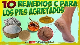 10 Remedios Caseros para los Pies y Talones Agrietados y Secos [upl. by Itoc435]